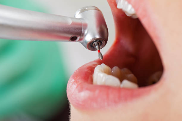 Best Walk-In Emergency Dental Services in Summersville, WV